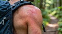 hydration pack chafing solutions