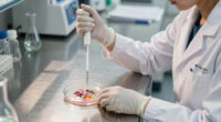 Columbia scientists discover surprising link between serotonin and heart valve disease