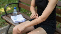 Rabies Exposure